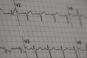 "ECG" por mgstanton bajo licencia CC BY-NC-ND 2.0